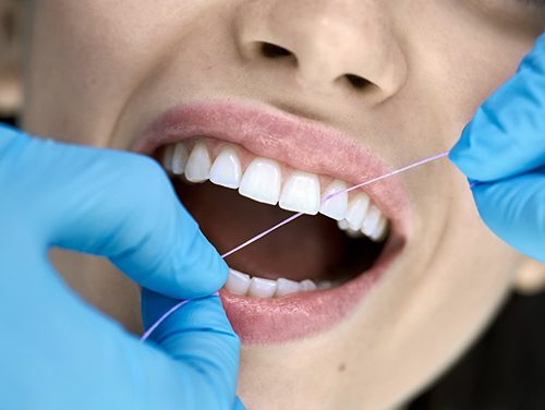 Dental hygienist flossing patient's teeth