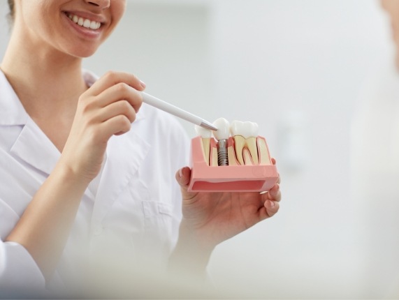 Dentist pointing to a dental implant in a model of the lower jaw