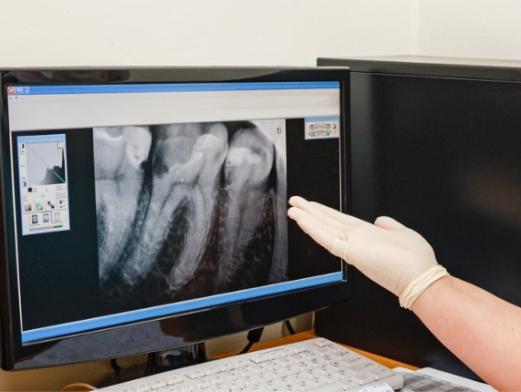 Dentist gesturing to computer screen showing digital dental x rays