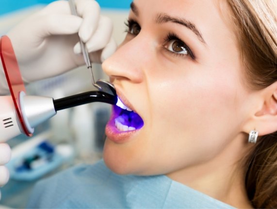 Woman getting direct bonding from dentist