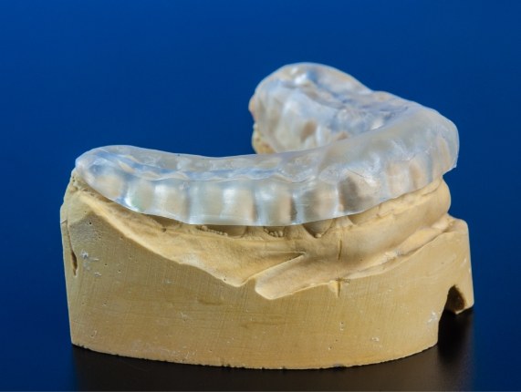 Clear nightguard resting on model of the lower teeth