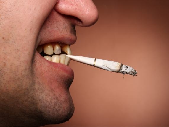 Close of person holding cigarette between their teeth