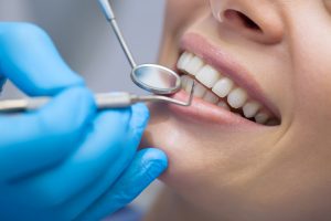 close-up of a healthy smile