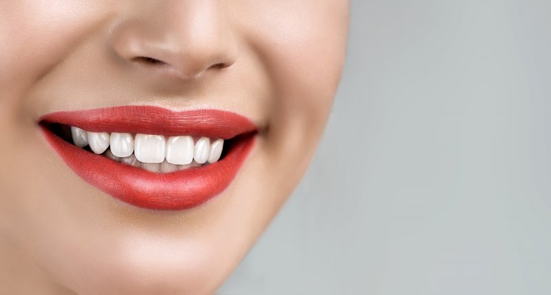 woman with beautiful veneers in West Orange