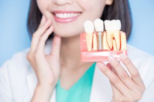 In the background a dentist holding her jaw and smiling while holding out a model of dental implants in the foreground