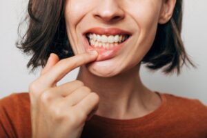 Woman pulling down lip to show gums. 