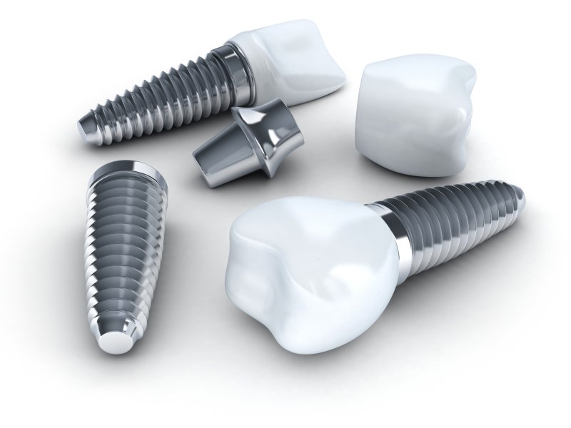 3D render of a dental implant